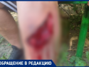 «Радуга смерти»: ребенок разорвал ногу до кости на детской площадке в Волжском