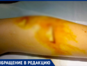 «Бросили ребенка, не оказав помощи»: волжанка ищет свидетелей нападения собаки на ее сына