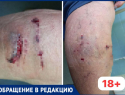 В Волжском прохожий безучастно наблюдал, как женщину грызли собаки