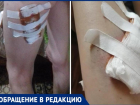 Свора бездомных собак растерзала девушку в сквере в Волжском
