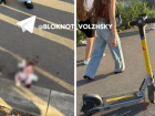 Сбитая электросамокатом в Волжском женщина боится еще одной сложной операции