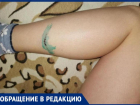 Стая собак напала на 12-летнего ребенка после школы в Волжском: фото