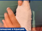 Ребенок сломал руку в летнем лагере на базе батутного городка в Волжском
