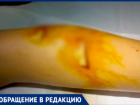 «Бросили ребенка, не оказав помощи»: волжанка ищет свидетелей нападения собаки на ее сына