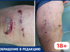 В Волжском прохожий безучастно наблюдал, как женщину грызли собаки