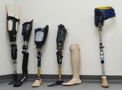 Волжанка добилась ремонта протеза через прокуратуру