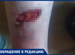 В Волжском 8-летней девочке зашивали ногу после укуса бездомной собаки