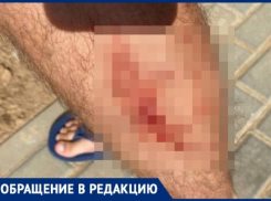 В Волжском ногу мужчины разодрала стая собак