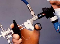 В волжскую больницу имени Фишера поступила современная гистеропомпа