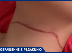 «Ловушка на детей»: 12-летний мальчик налетел горлом на натянутую леску во дворе Волгограда