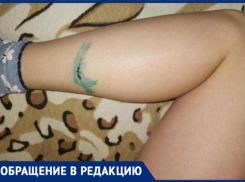Стая собак напала на 12-летнего ребенка после школы в Волжском: фото