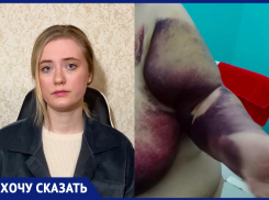 «Бабушка сходит с ума от боли. Рука почернела»: в Волжском пациентку бросили со сломанным плечом