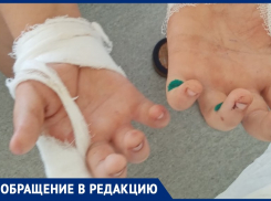 Рваные раны и синяки: ребенка едва спасли после нападения собак в Волжском