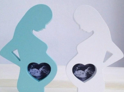 Волжский перинатальный  центр пополнился современным ультразвуковым аппаратом