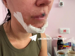 Дело о сбитой самокатом волжанке дошло до главы Следственного комитета России