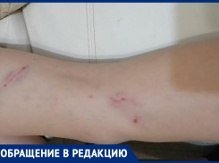 Стая собак напала на школьника: ребенка смогли отбить прохожие