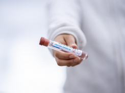 Почему мужчины умирают от коронавируса чаще женщин