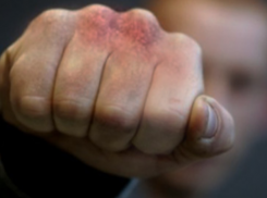 Супружескую пару избили и обокрали в Волжском