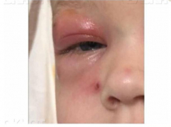 Волжским врачам, отказавшимся надеть бахилы, прочитали лекцию