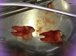 Волжанка продемонстрировала свою любовь к кровавым зубам