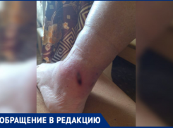 «Ждет жертву у школы»: бродячая собака терроризирует жителей поселка Краснооктябрьского