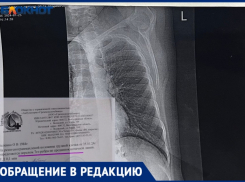«Путь с работы домой остался в памяти на всю жизнь»: волжанка сломала ребро из-за плохой очистки дорог