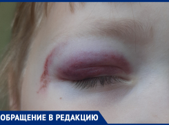Труба на детской площадке покалечила ребенка: волжанка