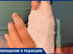 Ребенок сломал руку в летнем лагере на базе батутного городка в Волжском