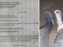 Мужчина сломал ногу, угодив в яму, оставленную дорожниками в Волжском