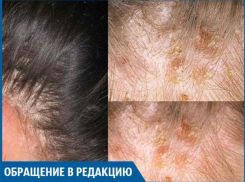 В салоне «Вероника» мне сожгли кожу головы, - волжанка