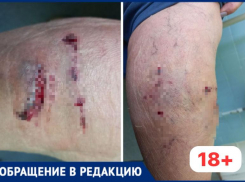 В Волжском прохожий безучастно наблюдал, как женщину грызли собаки