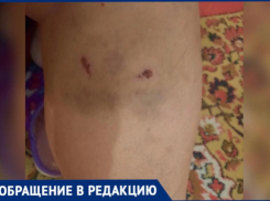 Свора чиповых собак напала на медсестру на территории больницы в Волжском  