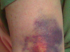 Ребенка изъяли из семьи за регулярные побои