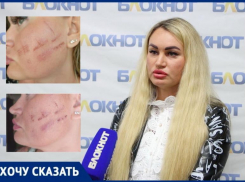 «Мне сожгли лицо, убеждая, что это нормально»: в Волжском в салоне красоты изуродовали женщину
