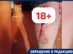 «Бродячие собаки  рвали клыками ногу моего сына»,- волжанка о страшном нападении