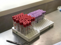 Пациентам Волгоградской области перелили около 666 литров антиковидной плазмы