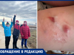 Чипированные собаки растерзали ребенка в Волжском: ФОТО