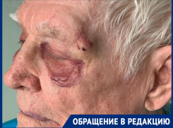 Волжанка напала на своих пожилых соседей и зверски их избила