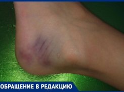«Дочь травмировала ножку на детской карусели», - волжанка