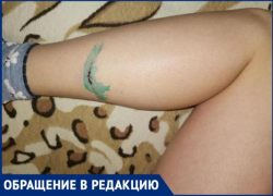 Стая собак напала на 12-летнего ребенка после школы в Волжском: фото