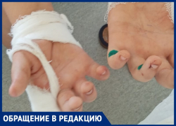 Рваные раны и синяки: ребенка едва спасли после нападения собак в Волжском