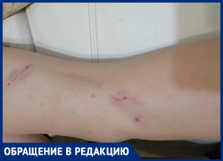 Стая собак напала на школьника: ребенка смогли отбить прохожие