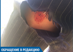 Я разодрала колено, упав в волгоградскую яму, - волжанка