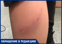 Агрессивные собаки истерзали школьника в Волжском