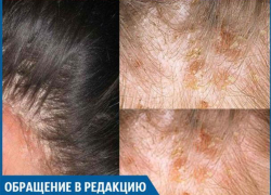 В салоне "Вероника" мне сожгли кожу головы, - волжанка