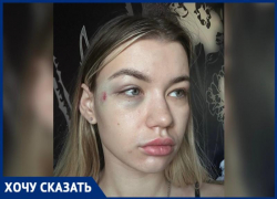 В Волжском девушку избили за отказ от прикосновений