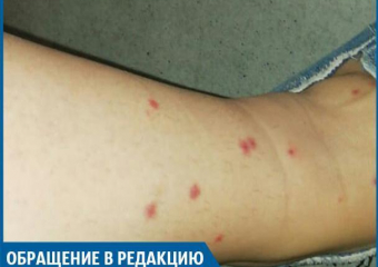 На улице Карбышева заживо съедают блохи, - волжанка