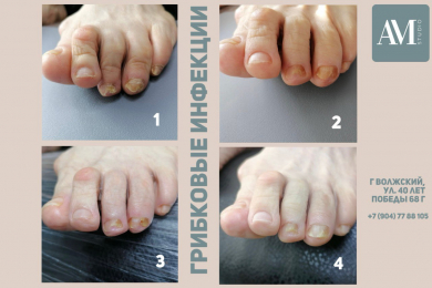 Прием мастера-подолога в AM Studio - 