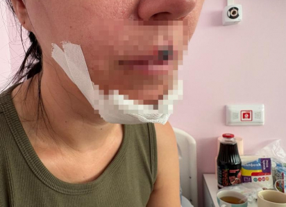 В Волжском вынесли приговор подростку, сбившей женщину с ребёнком на электросамокате