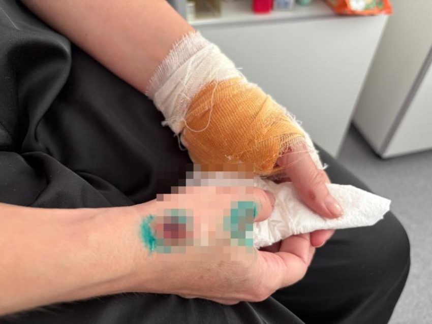 Жизнь разделилась на «до» и «после»: последствия трагедии с самокатом в Волжском